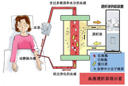 最新国产全自动腹透机，重塑透析治疗未来，引领医疗新篇章